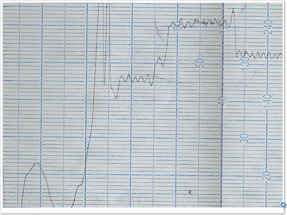 Collision Course Recorder